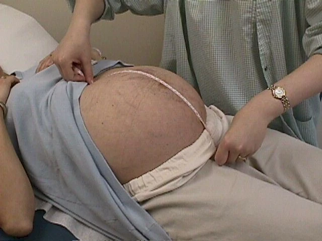 Tacrolimus and Pregnancy: What You Need to Know