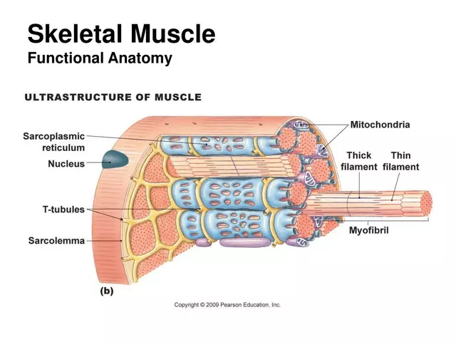 The Role of Prolotherapy in Treating Acute Skeletal Muscle Conditions